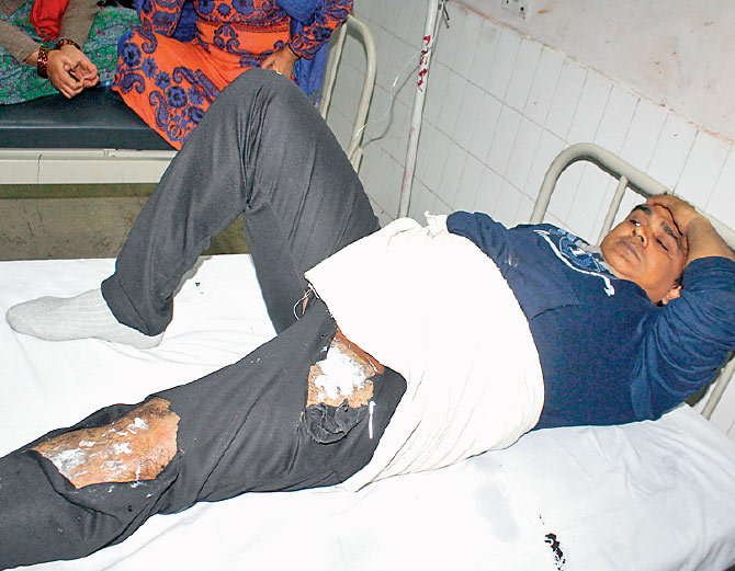 इलेक्ट्रीशियन प्रवीण शर्मा की जेब में रखा मोबाइल अचानक फट गया