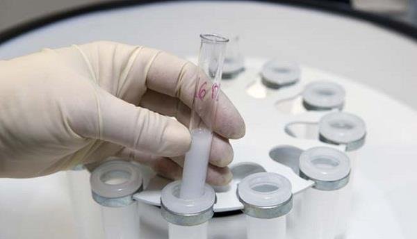 डोप टैस्ट की कीमत में  तीन गुणा बढ़ोतरी