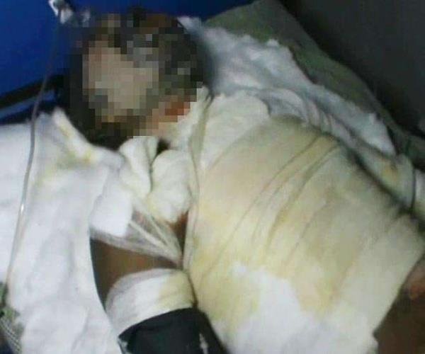 त्तर प्रदेश में कानपुर देहात के अकबरपुर क्षेत्र में मारपीट के बाद एक व्यक्ति को जलाकर हत्या का प्रयास करने का मामला