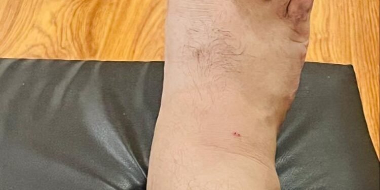 ਸਿੱਖਿਆ ਮੰਤਰੀ ਹਰਜੋਤ ਬੈਂਸ ਨੂੰ ਸੱਪ ਨੇ ਡੱਸਿਆ, ਹਸਪਤਾਲ ‘ਚ ਭਰਤੀ